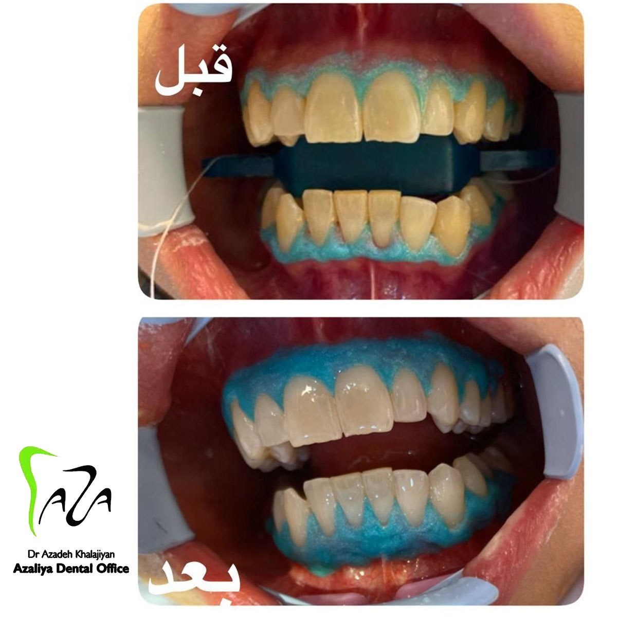 دکترآزاده خلجیان