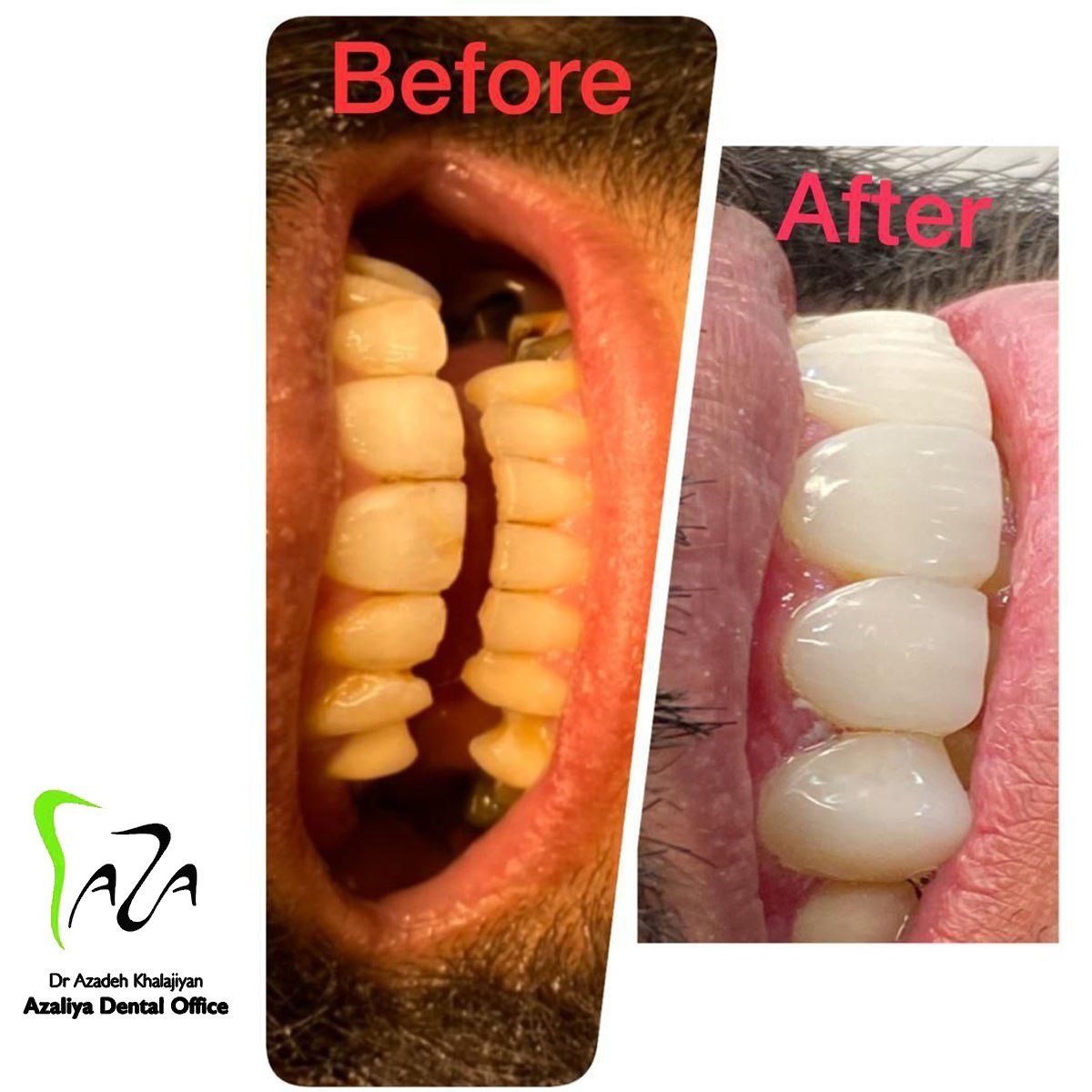 دکترآزاده خلجیان