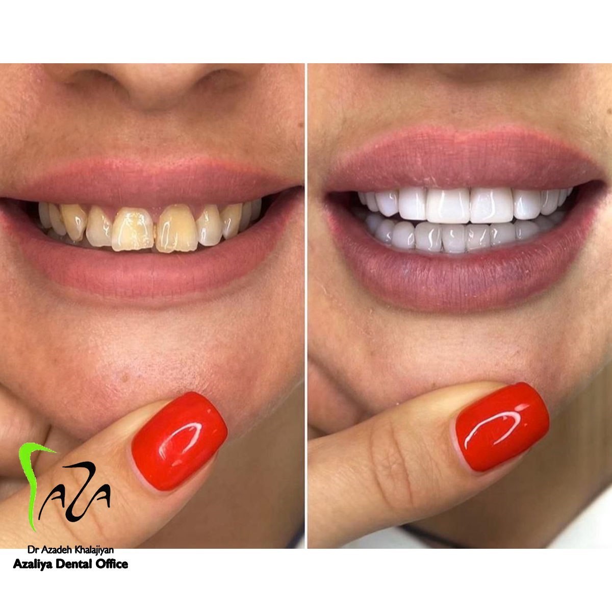 دکترآزاده خلجیان