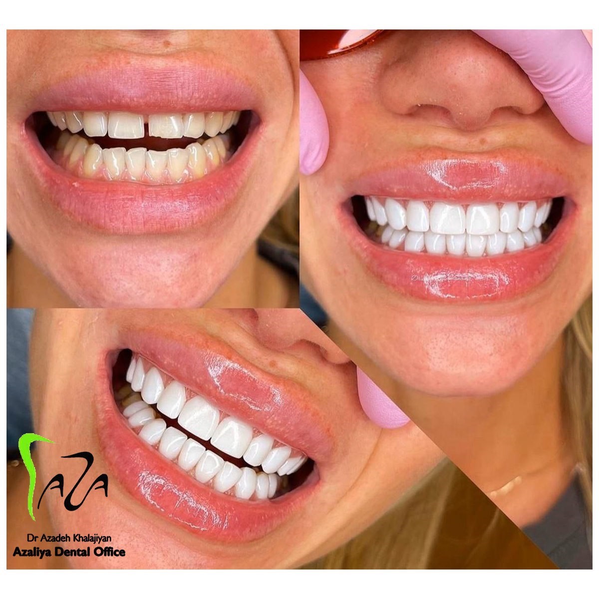 دکترآزاده خلجیان