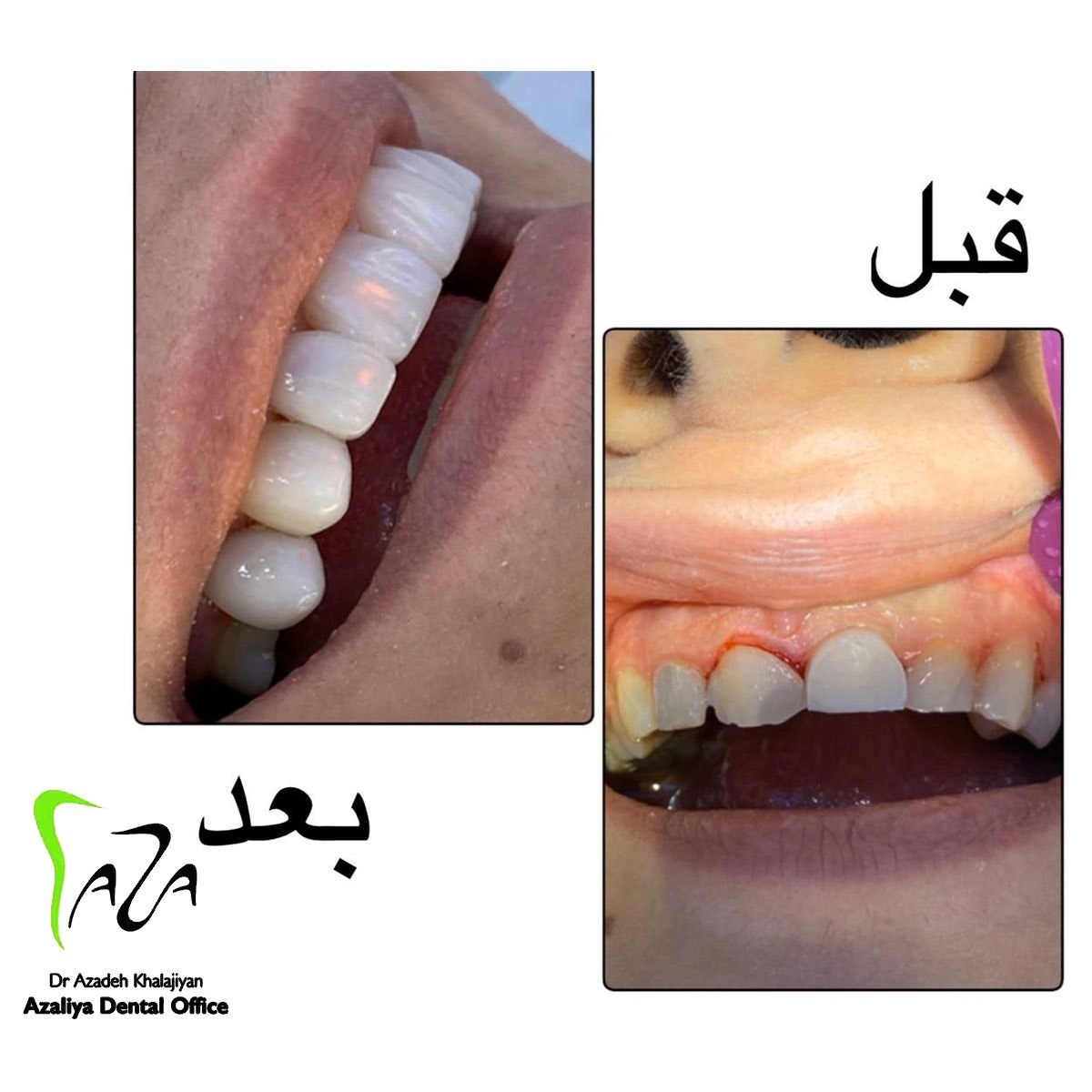 دکترآزاده خلجیان