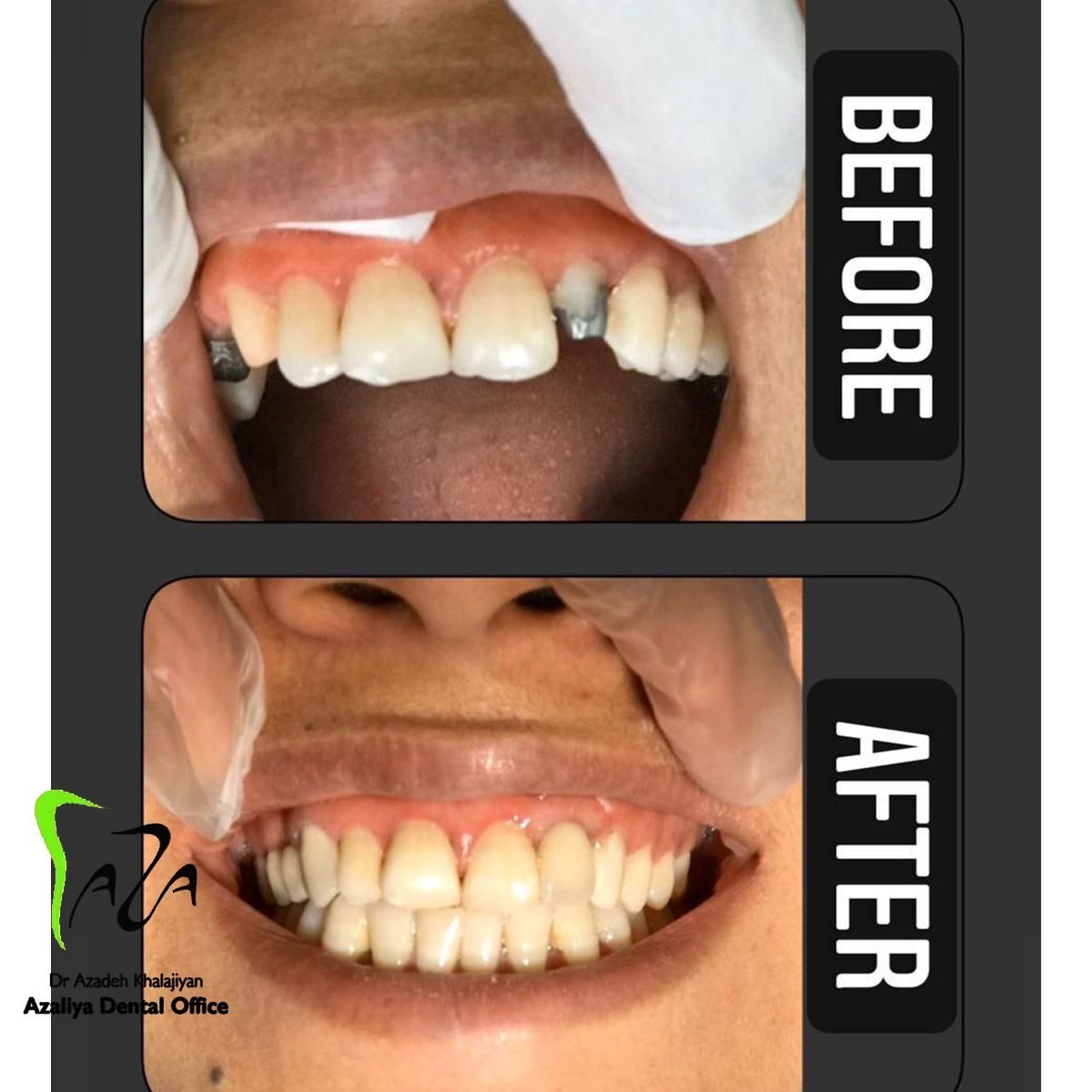 دکترآزاده خلجیان
