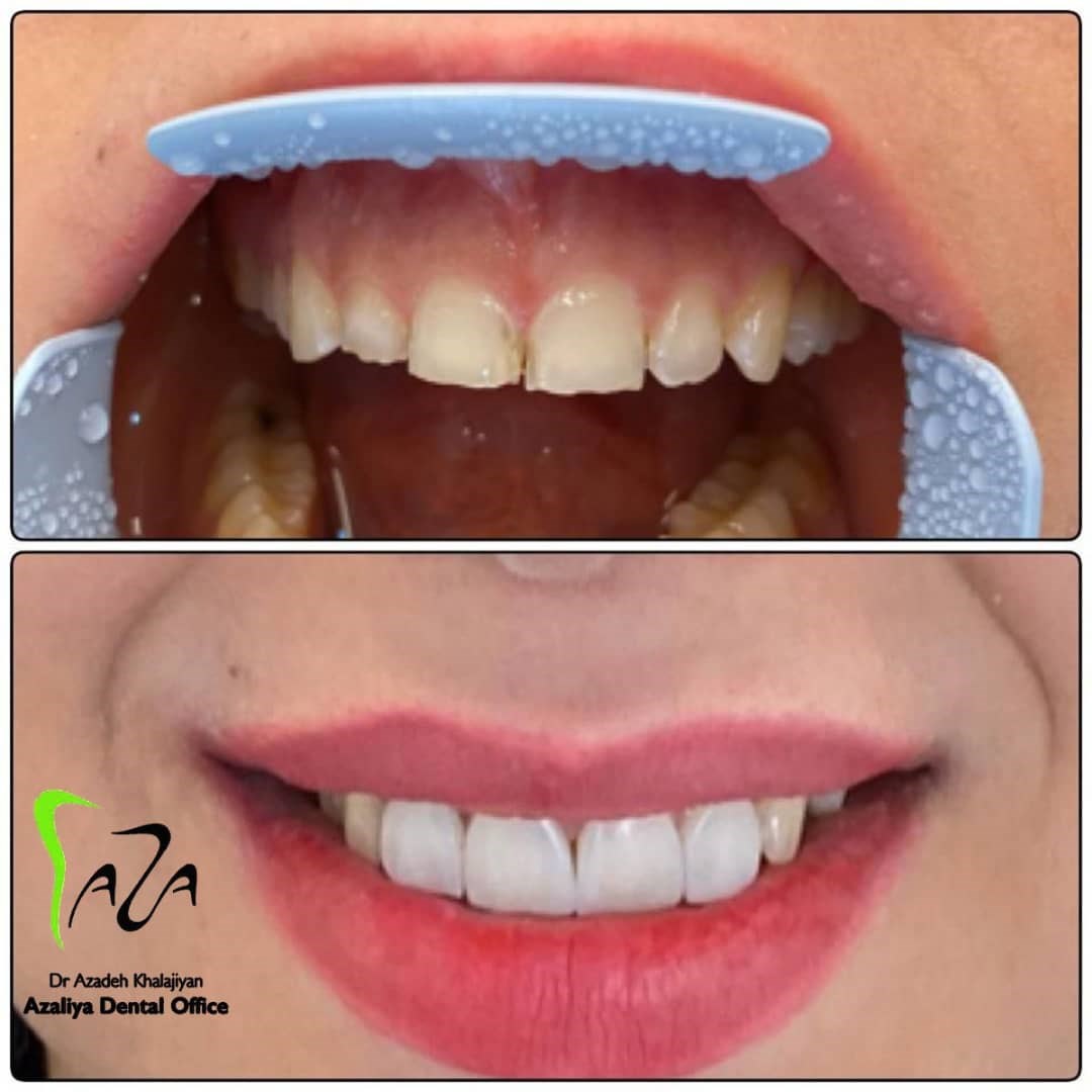 دکترآزاده خلجیان