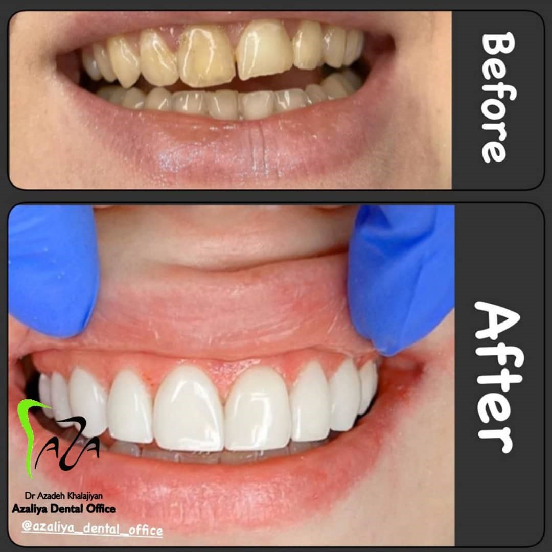 دکترآزاده خلجیان