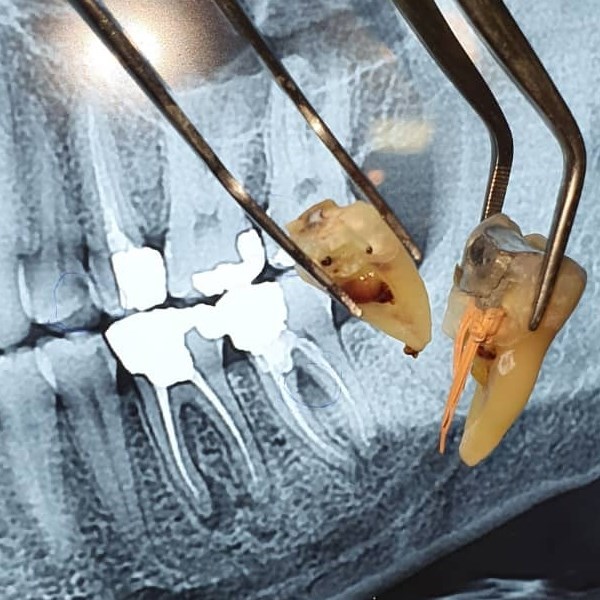 دکتر میترا وثوقی | جراح و متخصص درمان ریشه دندان
