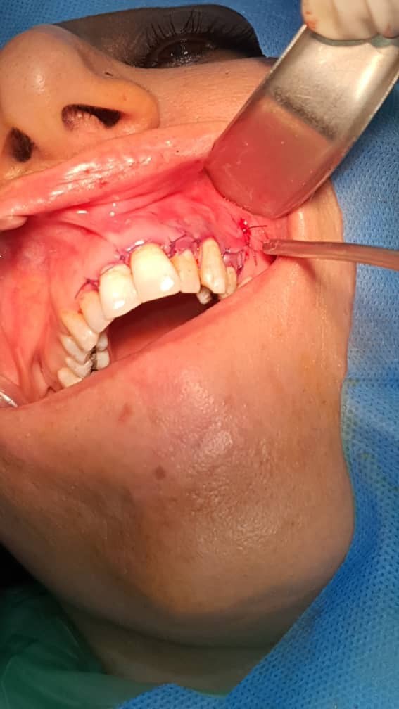 دکتر میترا وثوقی | جراح و متخصص درمان ریشه دندان