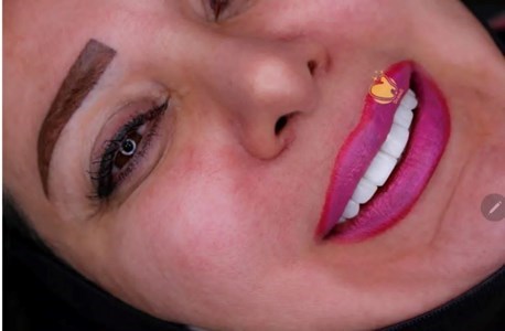 دکتر زهرا صوفی نژاد کامپوزیت ونییر,لمینت سرامیکی,اندو,پروتز جراح دندانپزشک در تهران