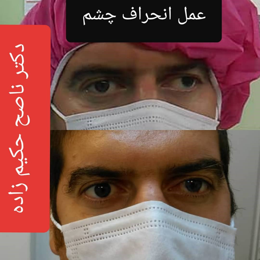  دکتر ناصح حکیم زاده جراح و متخصص بیماری های چشم