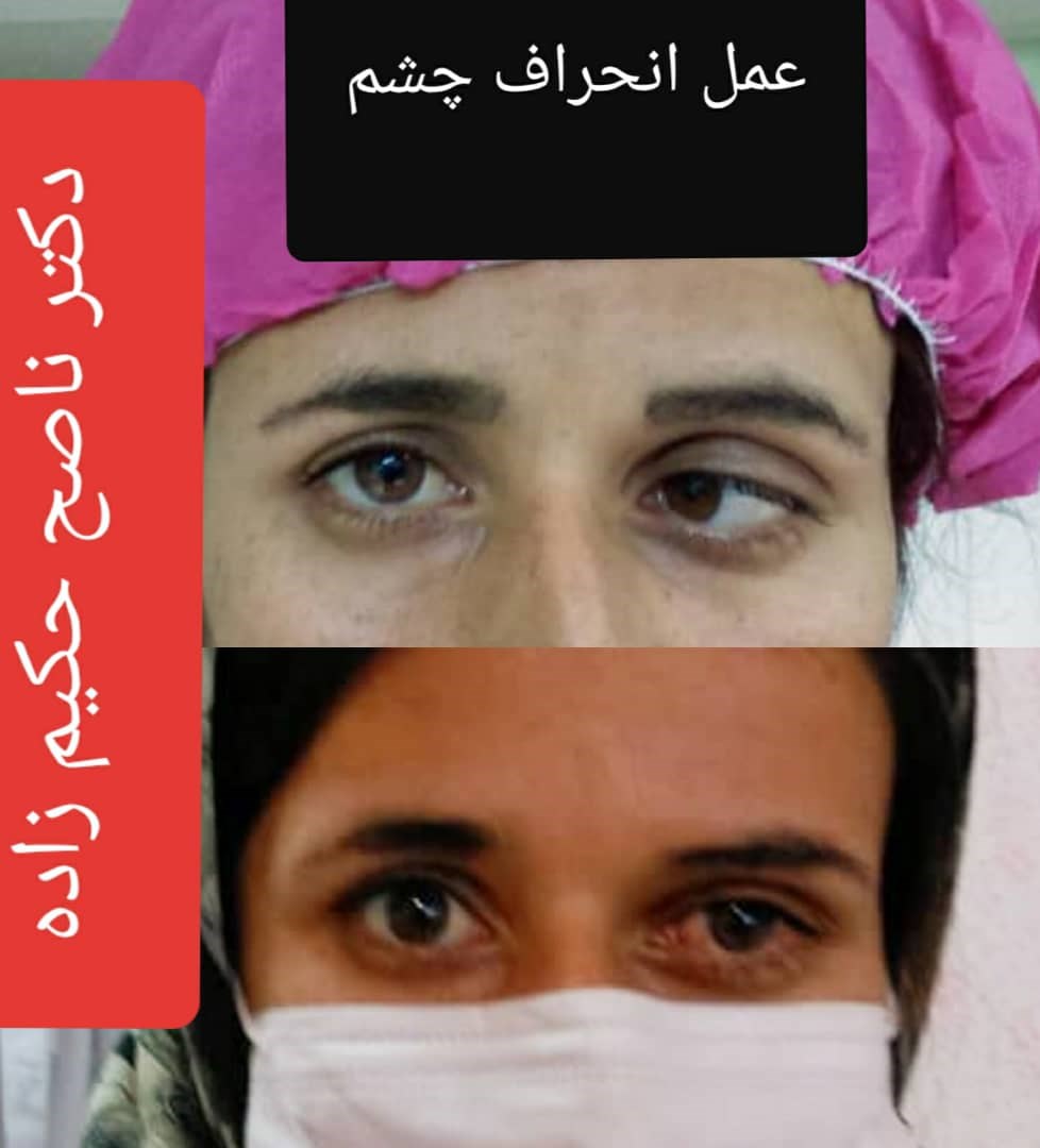  دکتر ناصح حکیم زاده جراح و متخصص بیماری های چشم