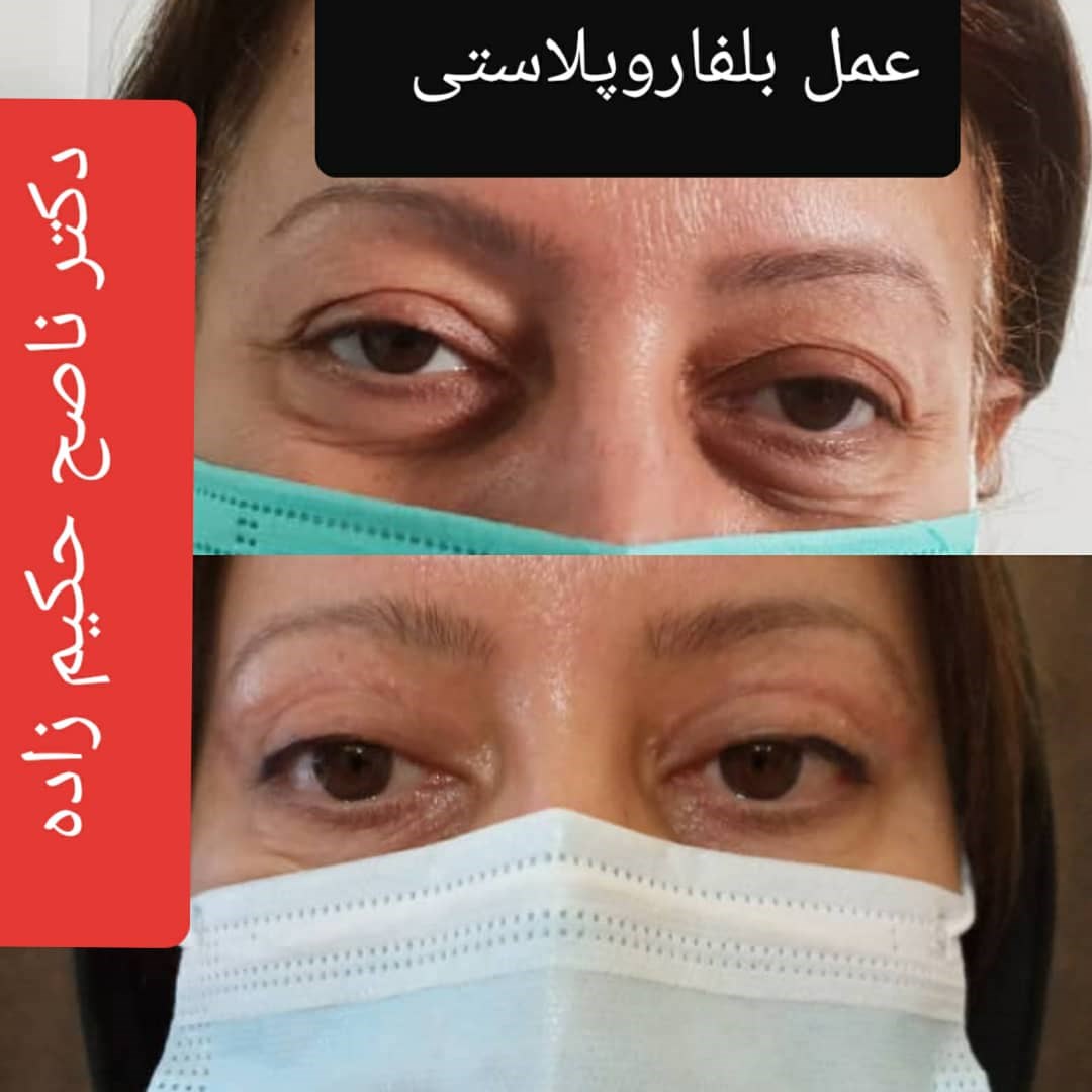  دکتر ناصح حکیم زاده جراح و متخصص بیماری های چشم