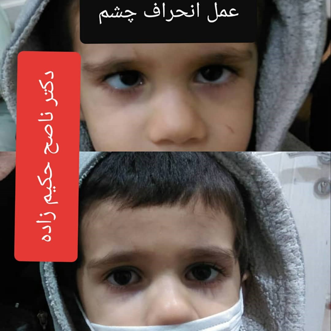 دکتر ناصح حکیم زاده جراح و متخصص بیماری های چشم