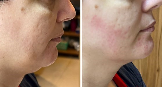 دکتر کامبیز ماهوتی متخصص پوست و مو