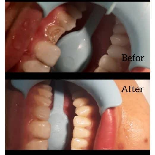 بهترین دندانپزشک نیشابور