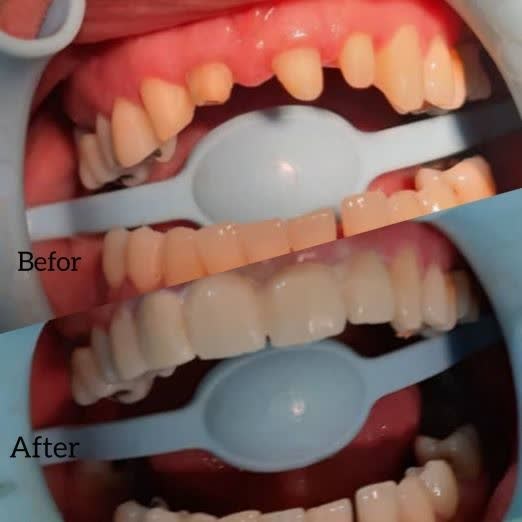 بهترین دندانپزشک نیشابور
