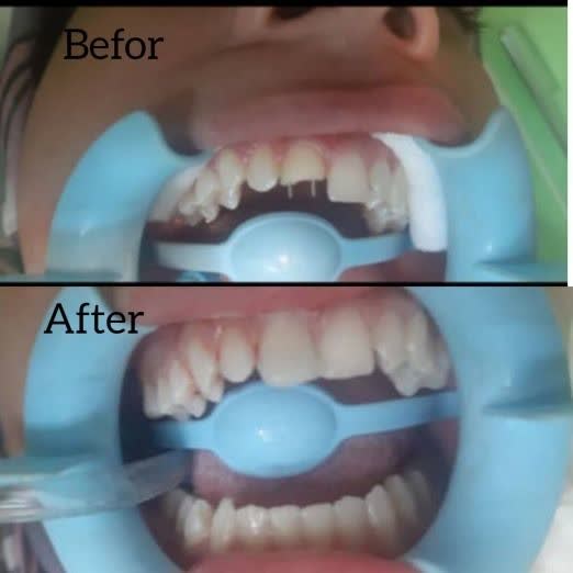 بهترین دندانپزشک نیشابور