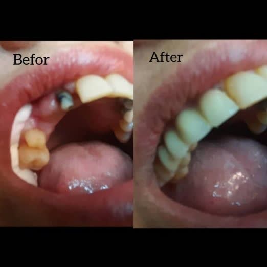 بهترین دندانپزشک نیشابور