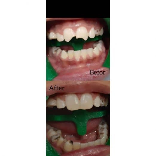بهترین دندانپزشک نیشابور